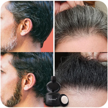 ✅✨Rolimey® – Sofort Ansatz- & Grauhaar-Abdeckung
