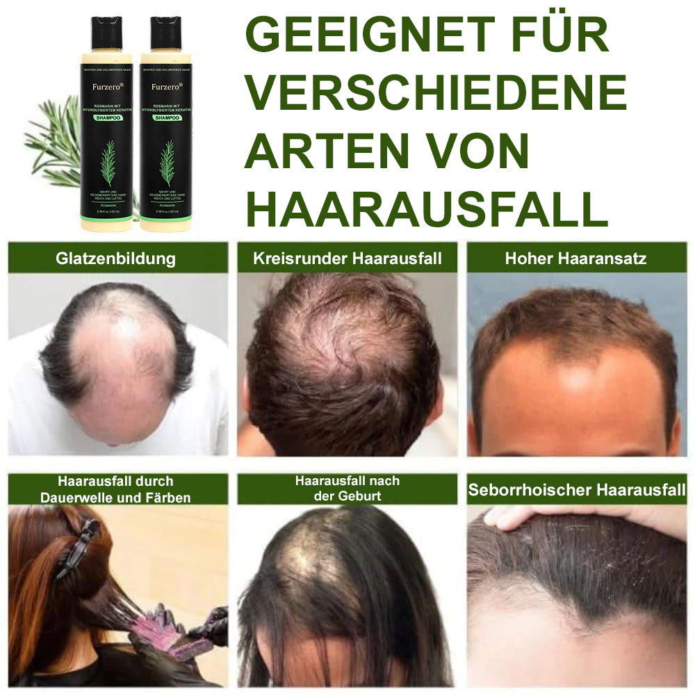 🔥LETZTER TAG 50% RABATT - ✨Furzero® Rosmarin-Shampoo mit hydrolysiertem Keratin