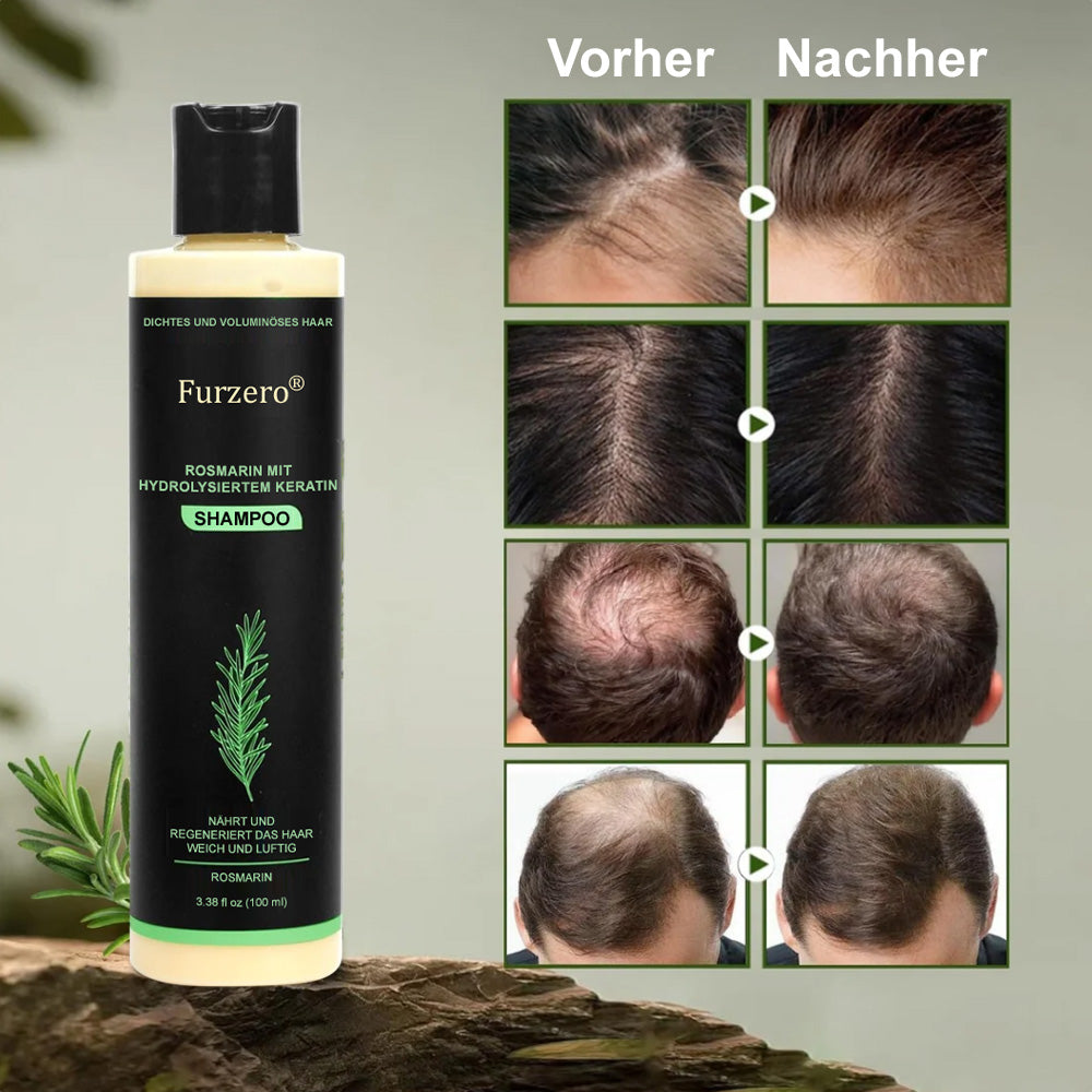 🔥LETZTER TAG 50% RABATT - ✨Furzero® Rosmarin-Shampoo mit hydrolysiertem Keratin