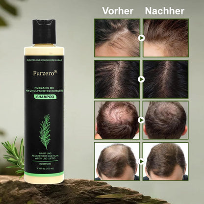 🔥LETZTER TAG 50% RABATT - ✨Furzero® Rosmarin-Shampoo mit hydrolysiertem Keratin