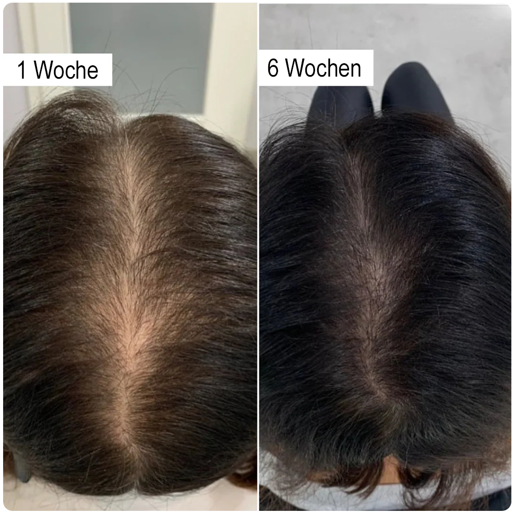 🔥LETZTER TAG 50% RABATT - ✨Furzero® Rosmarin-Shampoo mit hydrolysiertem Keratin