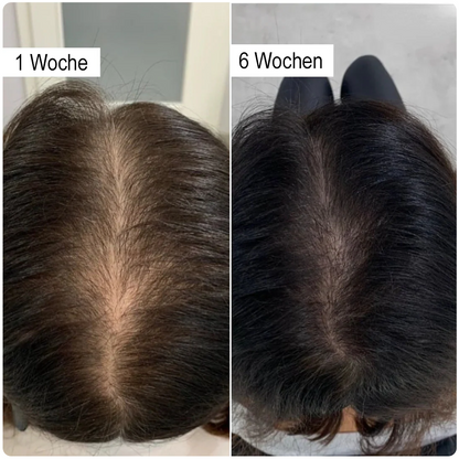 🔥LETZTER TAG 50% RABATT - ✨Furzero® Rosmarin-Shampoo mit hydrolysiertem Keratin